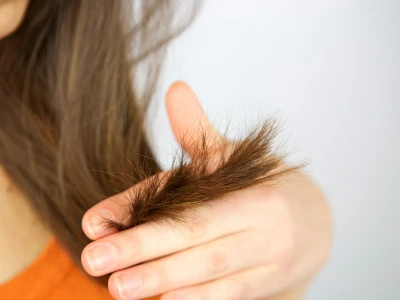 prevenir puntas abiertas